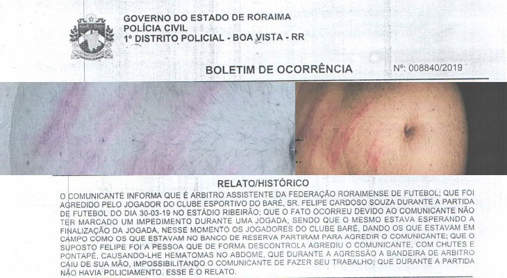  Em uma das súmulas enviadas pela FRF há relato de agressão e até Boletim de Ocorrência anexado!